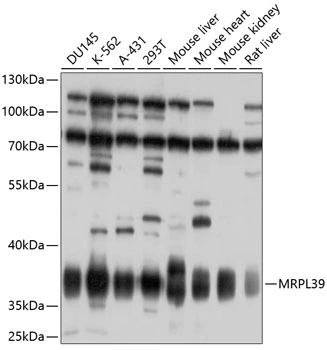 WB analysis of various sample lysates using GTX64754 MRPL39 antibody. Dilution : 1:1000 Loading : 25microg per lane WB analysis of various sample lysates using GTX64754 MRPL39 antibody. Dilution : 1:1000 Loading : 25microg per lane