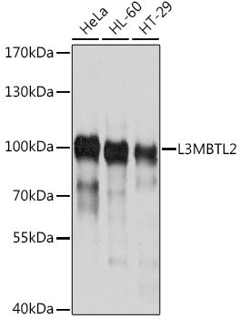 WB analysis of various sample lysates using GTX64756 L3MBTL2 antibody. Dilution : 1:1000 Loading : 25microg per lane WB analysis of various sample lysates using GTX64756 L3MBTL2 antibody. Dilution : 1:1000 Loading : 25microg per lane