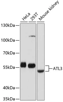 WB analysis of various sample lysates using GTX64758 ATL3 antibody. Dilution : 1:1000 Loading : 25microg per lane WB analysis of various sample lysates using GTX64758 ATL3 antibody. Dilution : 1:1000 Loading : 25microg per lane