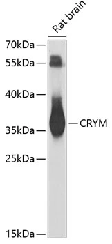WB analysis of rat brain tissue lysate using GTX64761 CRYM antibody. Dilution : 1:1000 Loading : 25microg per lane WB analysis of rat brain tissue lysate using GTX64761 CRYM antibody. Dilution : 1:1000 Loading : 25microg per lane