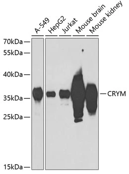 WB analysis of various sample lysates using GTX64761 CRYM antibody. Dilution : 1:1000 Loading : 25microg per lane