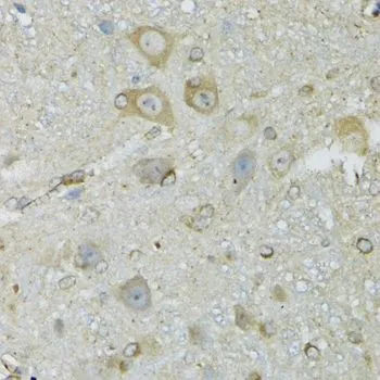 IHC-P analysis of mouse brain tissue using GTX64761 CRYM antibody. Dilution : 1:100