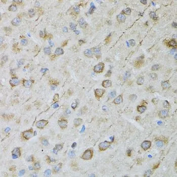 IHC-P analysis of rat brain tissue using GTX64761 CRYM antibody. Dilution : 1:100