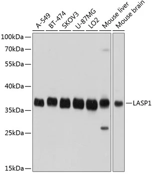 WB analysis of various sample lysates using GTX64762 LASP1 antibody. Dilution : 1:1000 Loading : 25microg per lane