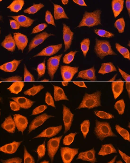 ICC/IF analysis of L929 cells using GTX64762 LASP1 antibody. Blue : DAPI Dilution : 1:100