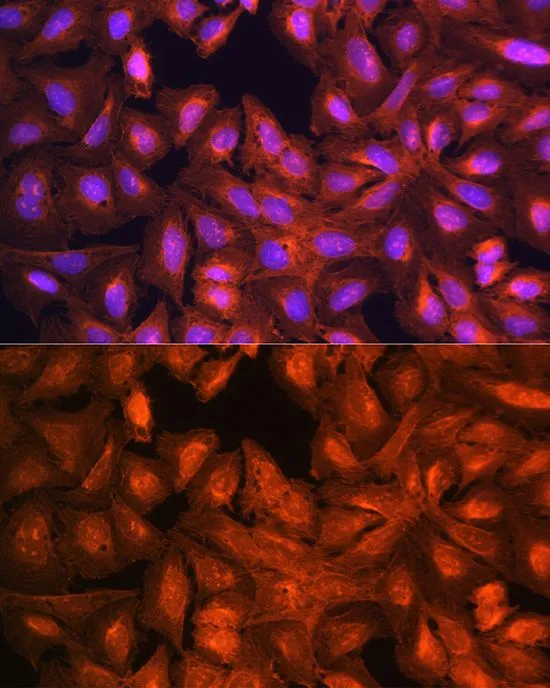 ICC/IF analysis of U2OS cells using GTX64762 LASP1 antibody. Blue : DAPI Dilution : 1:100