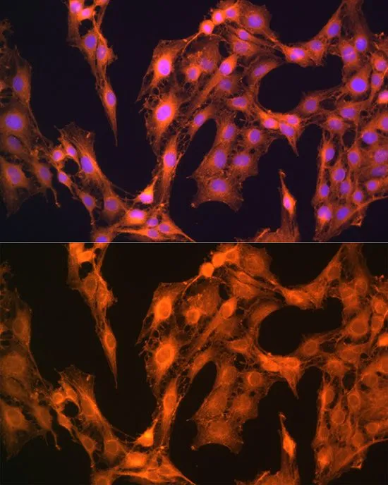 ICC/IF analysis of C6 cells using GTX64762 LASP1 antibody. Blue : DAPI Dilution : 1:100