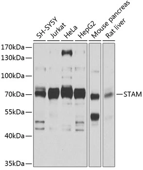 WB analysis of various sample lysates using GTX64764 STAM antibody. Dilution : 1:1000 Loading : 25microg per lane WB analysis of various sample lysates using GTX64764 STAM antibody. Dilution : 1:1000 Loading : 25microg per lane