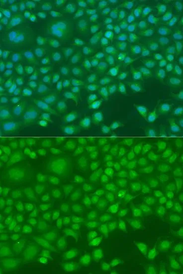 ICC/IF analysis of U2OS cells using GTX64771 Ninein antibody. Blue : DAPI Dilution : 1:100