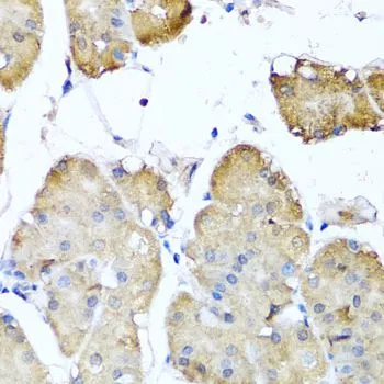 IHC-P analysis of human stomach tissue using GTX64771 Ninein antibody. Dilution : 1:100