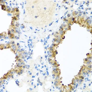 IHC-P analysis of mouse lung tissue using GTX64771 Ninein antibody. Dilution : 1:100