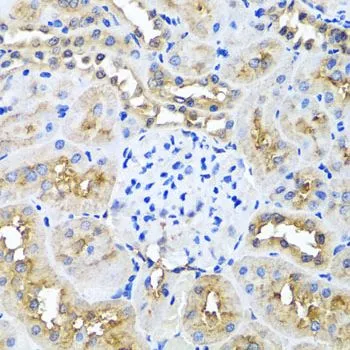 IHC-P analysis of rat kidney tissue using GTX64771 Ninein antibody. Dilution : 1:100