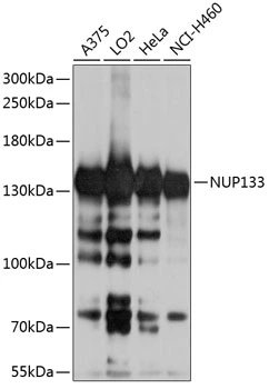 WB analysis of various sample lysates using GTX64772 NUP133 antibody. Dilution : 1:1000 Loading : 25microg per lane WB analysis of various sample lysates using GTX64772 NUP133 antibody. Dilution : 1:1000 Loading : 25microg per lane