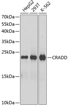 WB analysis of various sample lysates using GTX64784 RAIDD antibody. Dilution : 1:1000 Loading : 25microg per lane WB analysis of various sample lysates using GTX64784 RAIDD antibody. Dilution : 1:1000 Loading : 25microg per lane