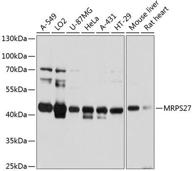 WB analysis of various sample lysates using GTX64786 MRPS27 antibody. Dilution : 1:3000 Loading : 25microg per lane WB analysis of various sample lysates using GTX64786 MRPS27 antibody. Dilution : 1:3000 Loading : 25microg per lane