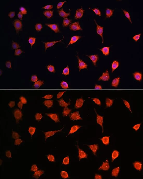 ICC/IF analysis of L929 cells using GTX64786 MRPS27 antibody. Blue : DAPI Dilution : 1:100