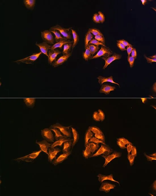 ICC/IF analysis of U2OS cells using GTX64786 MRPS27 antibody. Blue : DAPI Dilution : 1:100