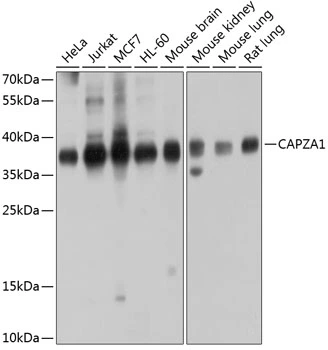 WB analysis of various sample lysates using GTX64789 CAPZA1 antibody. The signal was developed with ECL plus-Enhanced. Dilution : 1:1000 Loading : 25microg per lane WB analysis of various sample lysates using GTX64789 CAPZA1 antibody. The signal was developed with ECL plus-Enhanced. Dilution : 1:1000 Loading : 25microg per lane