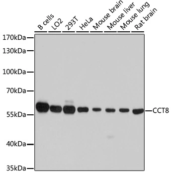 WB analysis of various sample lysates using GTX64792 TCP1 theta antibody. Dilution : 1:7000 Loading : 25microg per lane WB analysis of various sample lysates using GTX64792 TCP1 theta antibody. Dilution : 1:7000 Loading : 25microg per lane