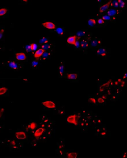 ICC/IF analysis of HeLa cells using GTX64792 TCP1 theta antibody. Blue : DAPI Dilution : 1:100