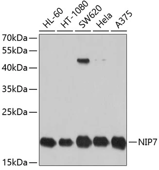 WB analysis of various sample lysates using GTX64793 NIP7 antibody. Dilution : 1:1000 Loading : 25microg per lane WB analysis of various sample lysates using GTX64793 NIP7 antibody. Dilution : 1:1000 Loading : 25microg per lane