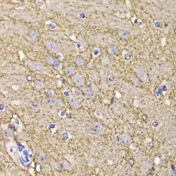 IHC-P analysis of mouse brain tissue using GTX64796 Kv4.3 antibody. Dilution : 1:100