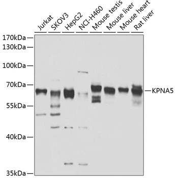 WB analysis of various sample lysates using GTX64797 KPNA5 antibody. The signal was developed with ECL plus-Enhanced. Dilution : 1:1000 Loading : 25microg per lane WB analysis of various sample lysates using GTX64797 KPNA5 antibody. The signal was developed with ECL plus-Enhanced. Dilution : 1:1000 Loading : 25microg per lane