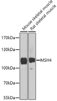 WB analysis of various sample lysates using GTX64804 MSH4 antibody. The signal was developed with ECL plus-Enhanced. Dilution : 1:1000 Loading : 25microg per lane WB analysis of various sample lysates using GTX64804 MSH4 antibody. The signal was developed with ECL plus-Enhanced. Dilution : 1:1000 Loading : 25microg per lane
