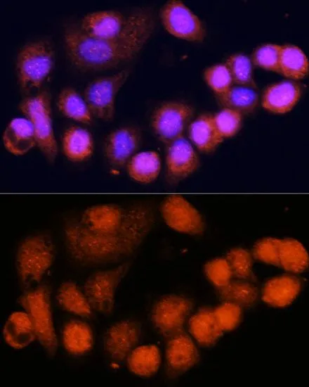 ICC/IF analysis of OVCAR-3 cells using GTX64804 MSH4 antibody. Blue : DAPI Dilution : 1:100