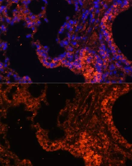 IHC-P analysis of mouse lung tissue using GTX64806 alpha 1 Spectrin antibody. Blue : DAPI Dilution : 1:100