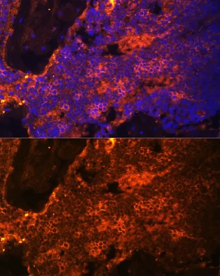 IHC-P analysis of rat bone marrow tissue using GTX64806 alpha 1 Spectrin antibody. Blue : DAPI Dilution : 1:100