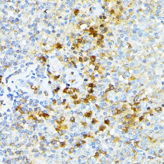 IHC-P analysis of human tonsil tissue using GTX64806 alpha 1 Spectrin antibody. Dilution : 1:100