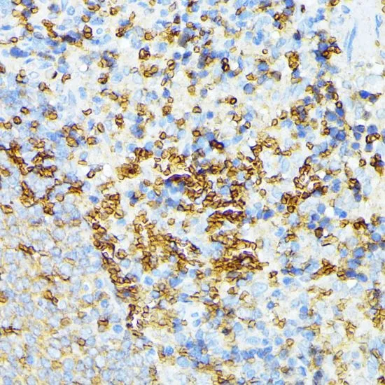 IHC-P analysis of rat spleen tissue using GTX64806 alpha 1 Spectrin antibody. Dilution : 1:100