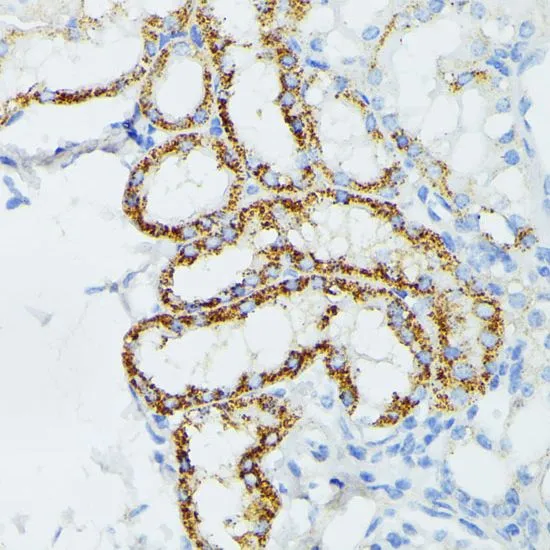 IHC-P analysis of mouse kidney tissue using GTX64809 ETHE1 antibody. Dilution : 1:100