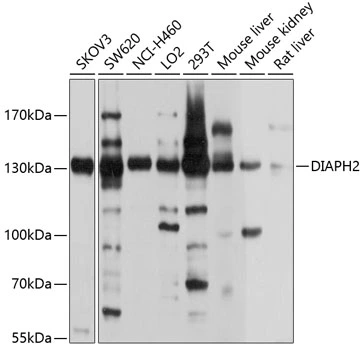 WB analysis of various sample lysates using GTX64810 DIAPH2 antibody. Dilution : 1:1000 Loading : 25microg per lane WB analysis of various sample lysates using GTX64810 DIAPH2 antibody. Dilution : 1:1000 Loading : 25microg per lane