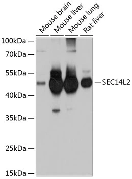 WB analysis of various sample lysates using GTX64814 SEC14L2 antibody. Dilution : 1:1000 Loading : 25microg per lane WB analysis of various sample lysates using GTX64814 SEC14L2 antibody. Dilution : 1:1000 Loading : 25microg per lane