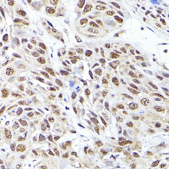 ICC/IF analysis of U2OS cells using GTX64814 SEC14L2 antibody. Blue : DAPI Dilution : 1:100