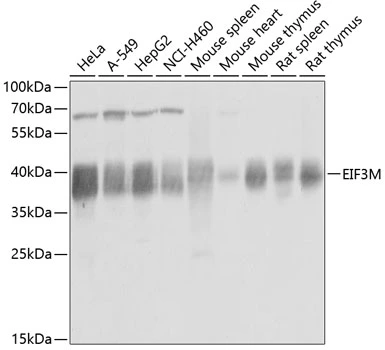 WB analysis of various sample lysates using GTX64817 PCID1 antibody. Dilution : 1:1000 Loading : 25microg per lane WB analysis of various sample lysates using GTX64817 PCID1 antibody. Dilution : 1:1000 Loading : 25microg per lane