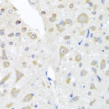 IHC-P analysis of rat brain tissue using GTX64817 PCID1 antibody. Dilution : 1:100
