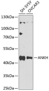 IHC-P analysis of human prostate tissue using GTX64821 ANKH antibody. Dilution : 1:100