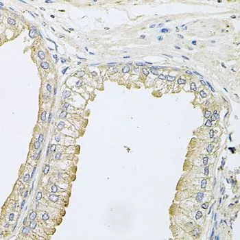 IHC-P analysis of human prostate tissue using GTX64821 ANKH antibody. Dilution : 1:100