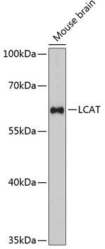 WB analysis of mouse brain tissue lysate using GTX64822 LCAT antibody. Dilution : 1:3000 Loading : 25microg per lane WB analysis of mouse brain tissue lysate using GTX64822 LCAT antibody. Dilution : 1:3000 Loading : 25microg per lane