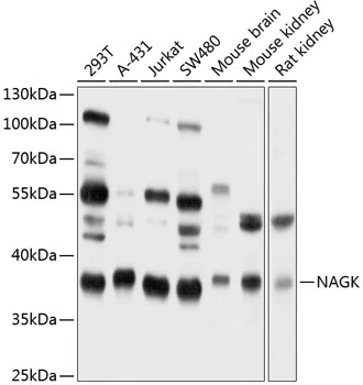WB analysis of various sample lysates using GTX64828 NAGK antibody. Dilution : 1:1000 Loading : 25microg per lane WB analysis of various sample lysates using GTX64828 NAGK antibody. Dilution : 1:1000 Loading : 25microg per lane