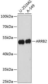 WB analysis of various sample lysates using GTX64830 Beta Arrestin 2 antibody. The signal was developed with ECL plus-Enhanced. Dilution : 1:1000 Loading : 25microg per lane WB analysis of various sample lysates using GTX64830 Beta Arrestin 2 antibody. The signal was developed with ECL plus-Enhanced. Dilution : 1:1000 Loading : 25microg per lane