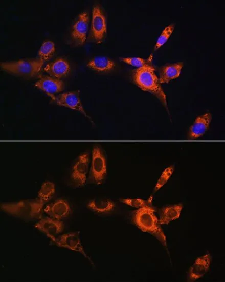 ICC/IF analysis of NIH/3T3 cells using GTX64830 Beta Arrestin 2 antibody. Blue : DAPI Dilution : 1:100