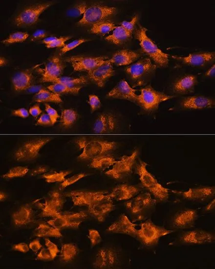 ICC/IF analysis of C6 cells using GTX64830 Beta Arrestin 2 antibody. Blue : DAPI Dilution : 1:100