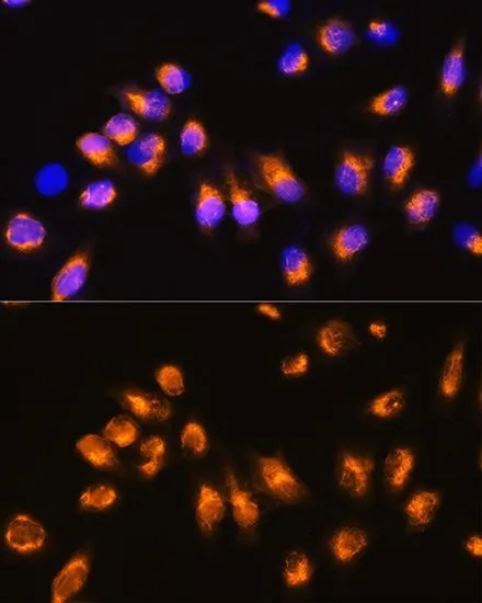 ICC/IF analysis of HeLa cells using GTX64830 Beta Arrestin 2 antibody. Blue : DAPI Dilution : 1:100