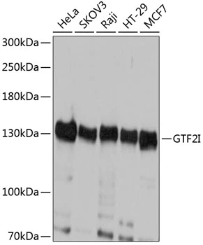 WB analysis of various sample lysates using GTX64832 TFII-I antibody. Dilution : 1:1000 Loading : 25microg per lane