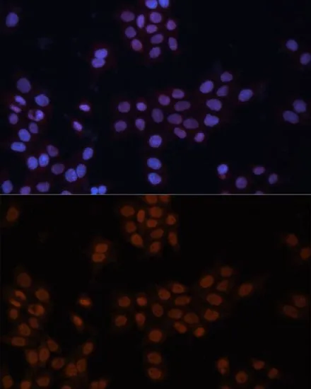 ICC/IF analysis of HeLa cells using GTX64832 TFII-I antibody. Blue : DAPI Dilution : 1:100