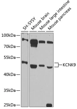 WB analysis of various sample lysates using GTX64833 KCNK9 antibody. Dilution : 1:1000 Loading : 25microg per lane WB analysis of various sample lysates using GTX64833 KCNK9 antibody. Dilution : 1:1000 Loading : 25microg per lane